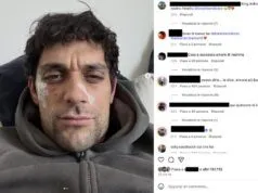 Bresh ferito al volto ironizza: Dobermann 1 – Andrea 0 Bresh ferito al volto ironizza: Dobermann 1 - Andrea 0